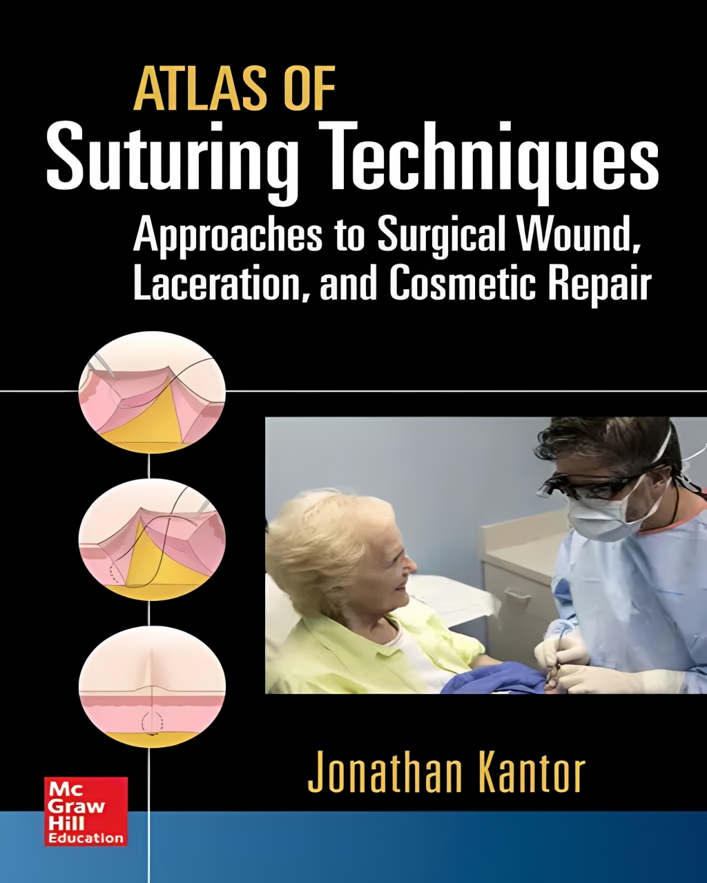 Atlas of suturing techniques : approaches to surgical wound, laceration, and cosmetic repair