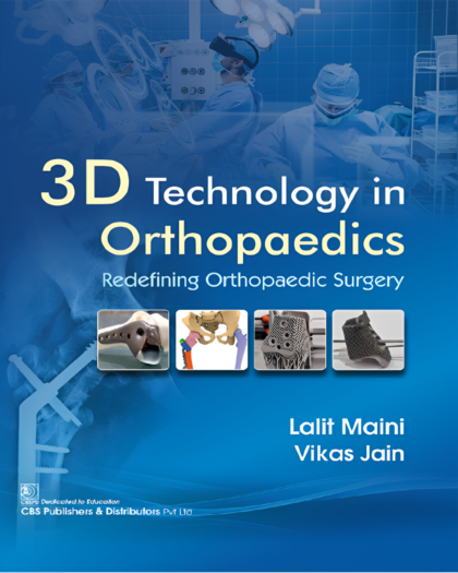3D Technology in Orthopedics