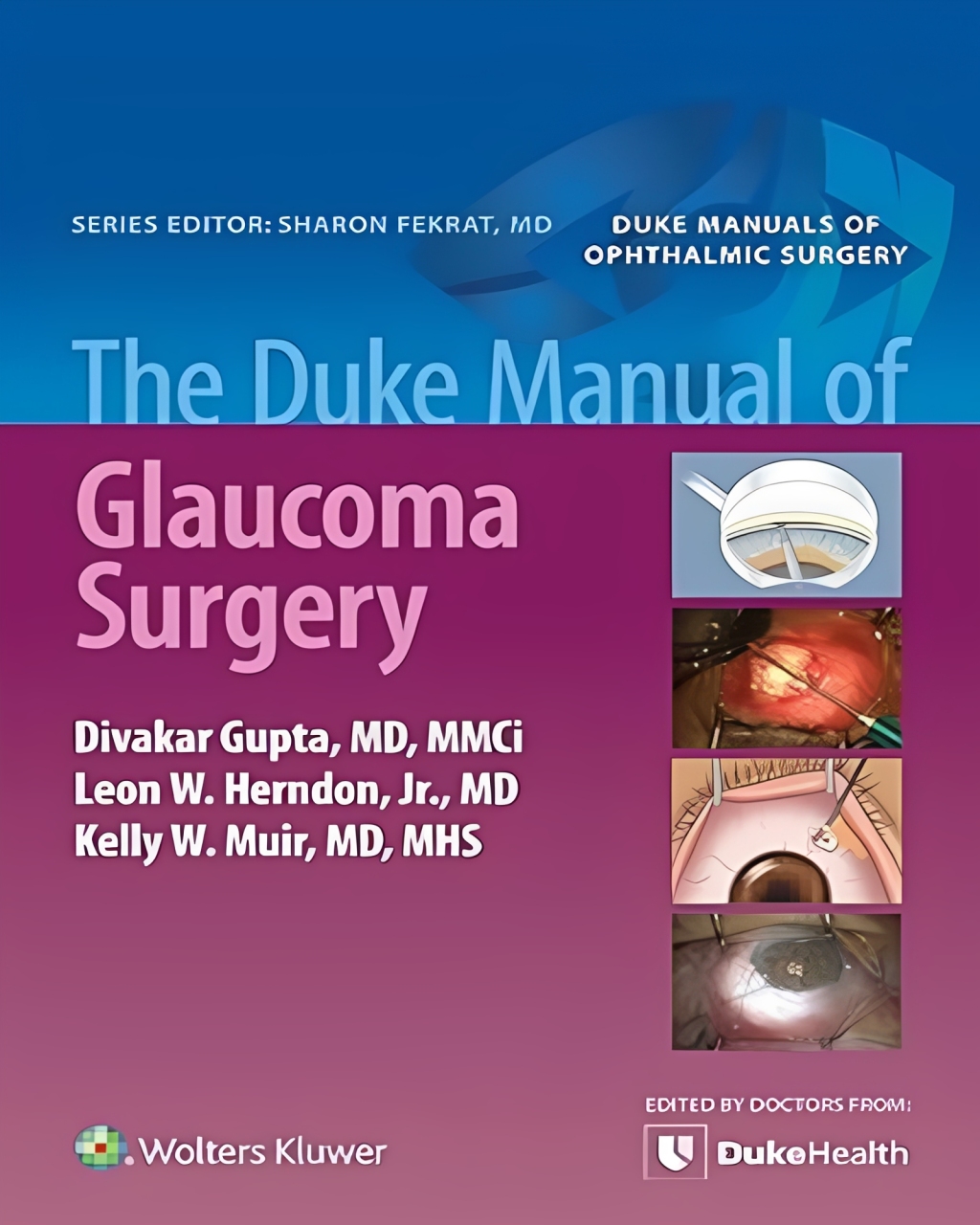 The Duke Manual of Glaucoma Surgery First Edition