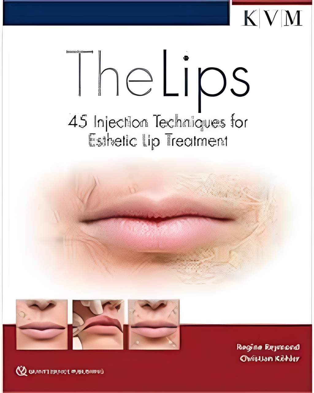 The Lips: 45 Injection Techniques for Esthetic Lip Treatment (Aesthetic Methods for Skin Rejuvination) 1st Edition