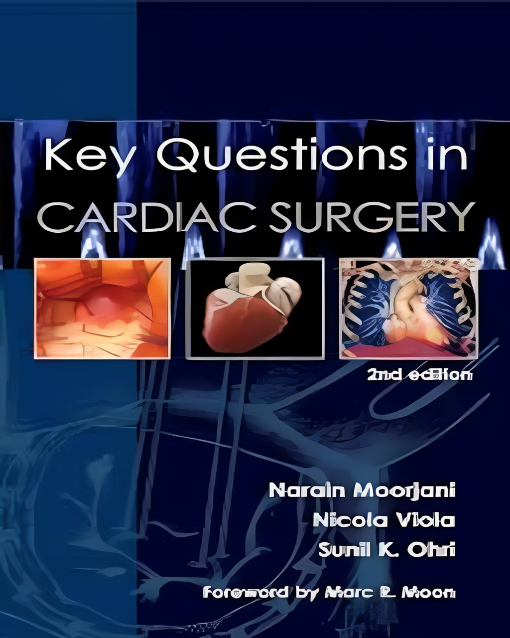 Key Questions in Cardiac Surgery