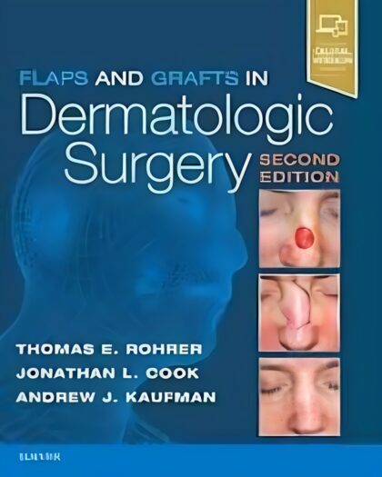 Flaps and Grafts in Dermatologic Surgery: Text with DVD