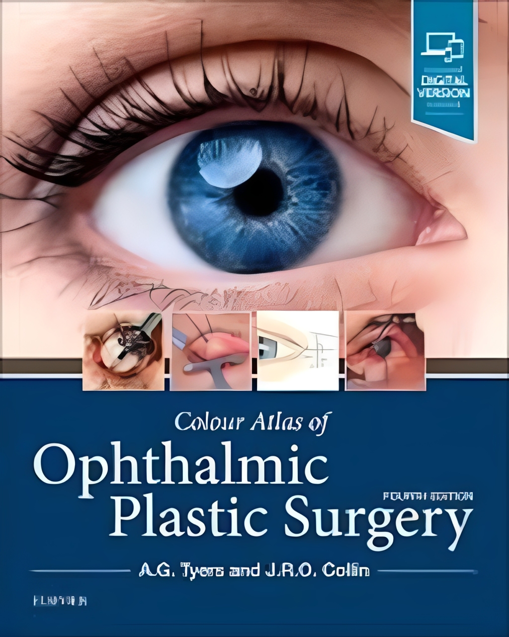 Colour atlas of ophthalmic plastic surgery